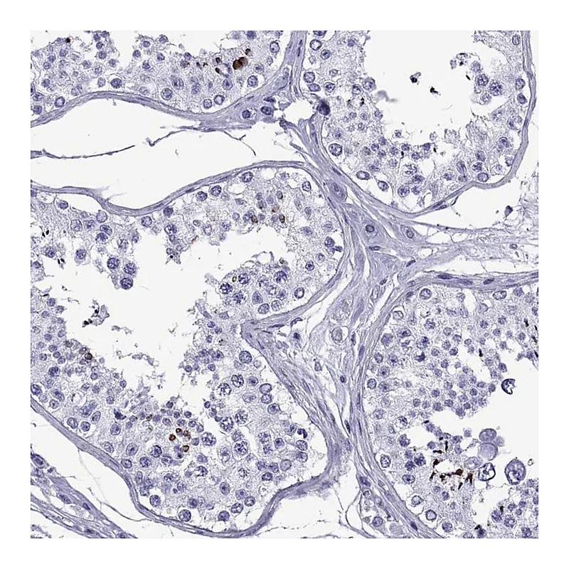 Atlas Antibodies Anti-SPANXC Antibody