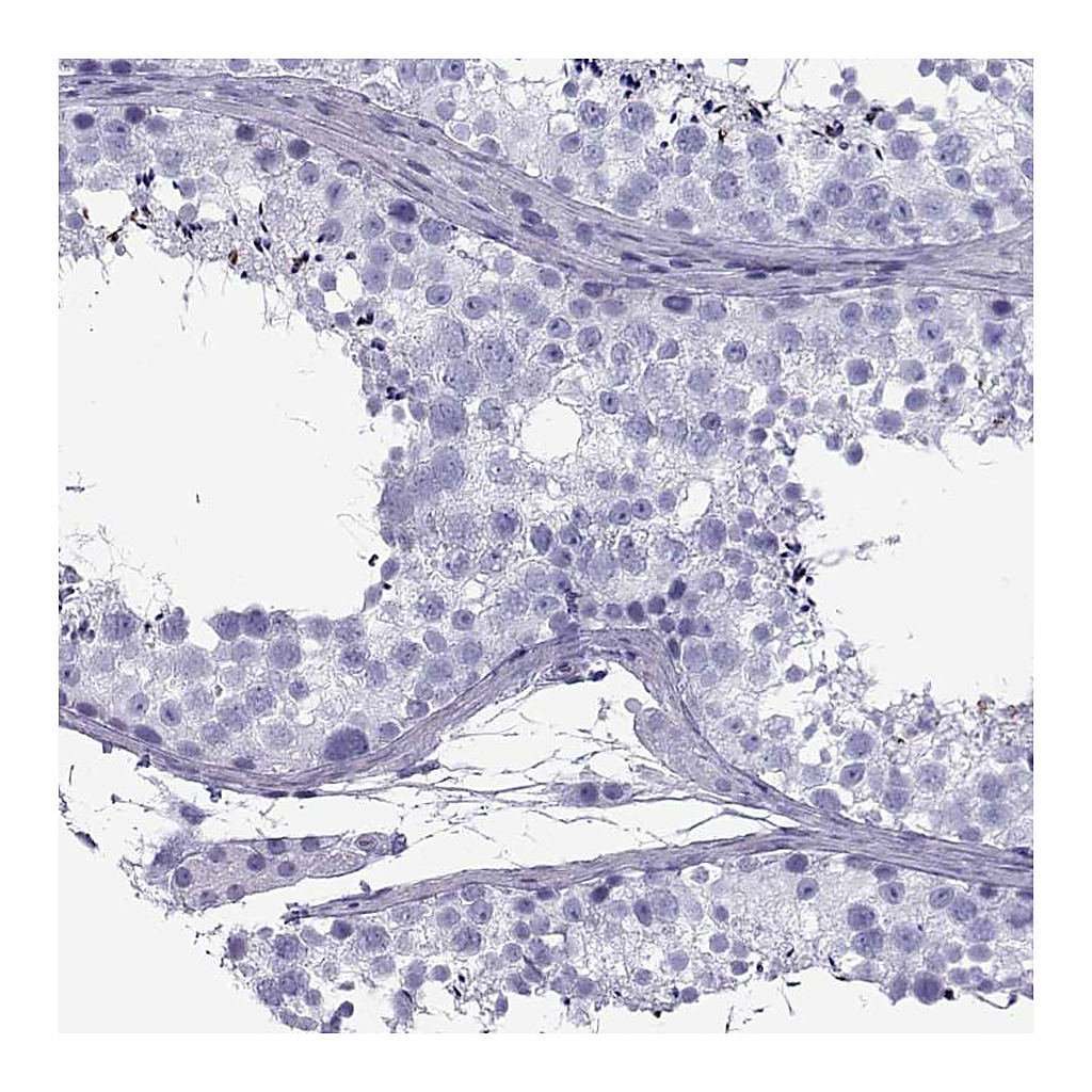 Atlas Antibodies Anti-SPANXD Antibody
