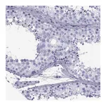 Atlas Antibodies Anti-SPANXD Antibody