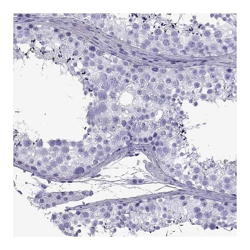 Atlas Antibodies Anti-SPANXD Antibody