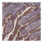Atlas Antibodies Anti-SPATA13 Antibody