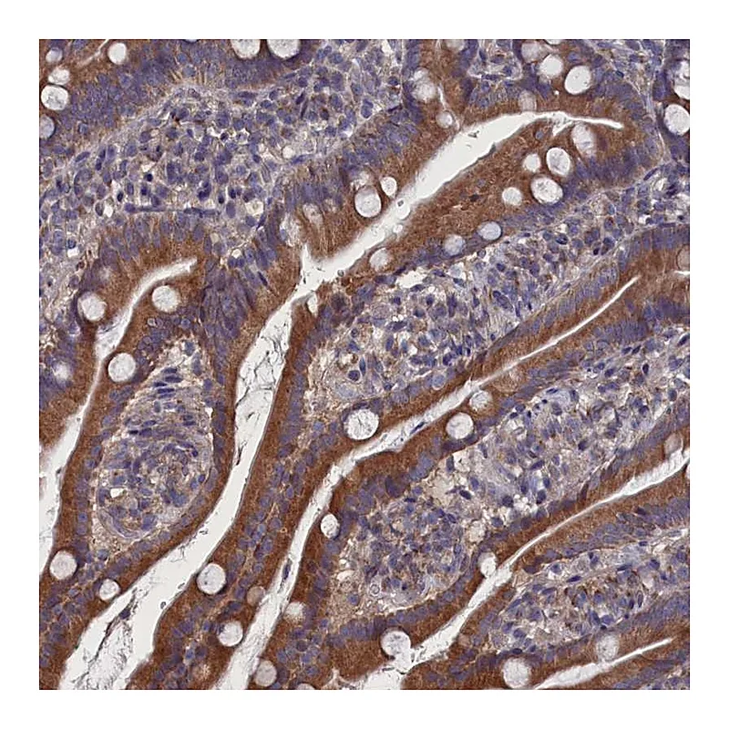 Atlas Antibodies Anti-SPATA13 Antibody