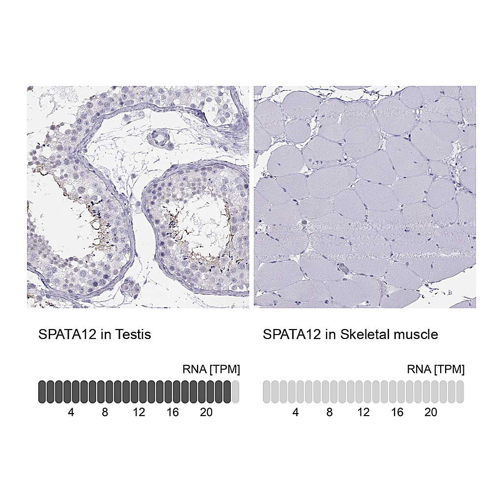 Atlas Antibodies Anti-SPATA12 Antibody