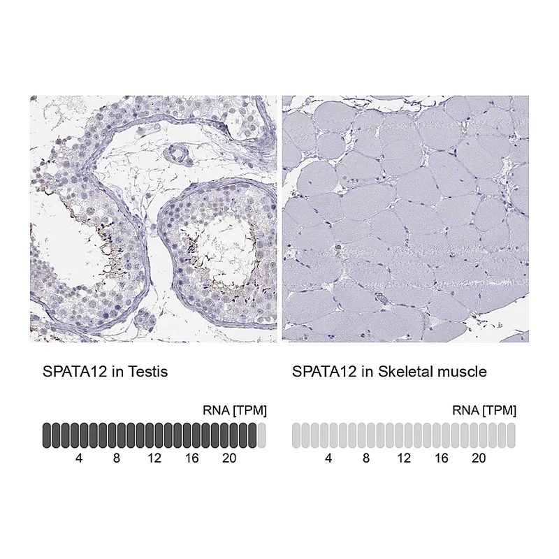 Atlas Antibodies Anti-SPATA12 Antibody