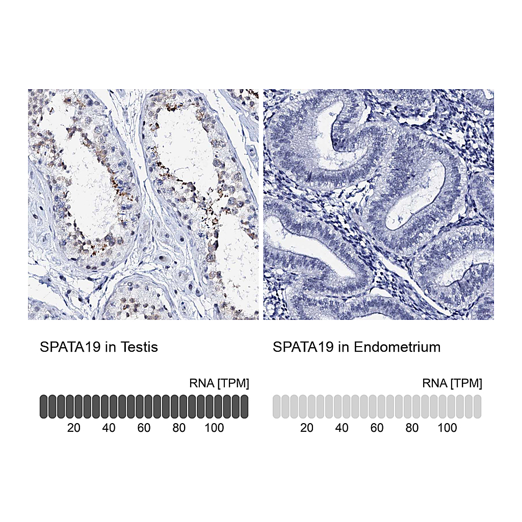 Atlas Antibodies Anti-SPATA19 Antibody