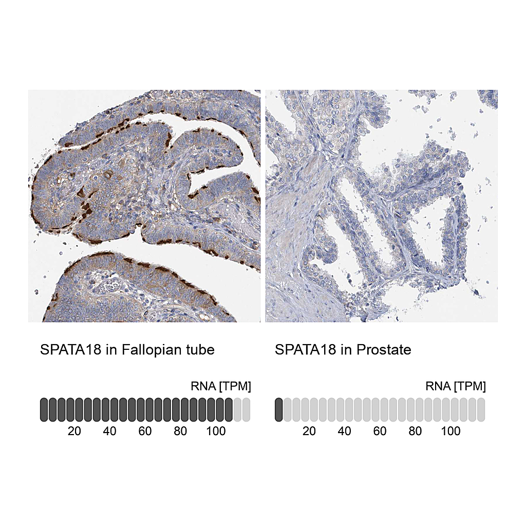 Atlas Antibodies Anti-SPATA18 Antibody