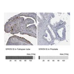 Atlas Antibodies Anti-SPATA18 Antibody