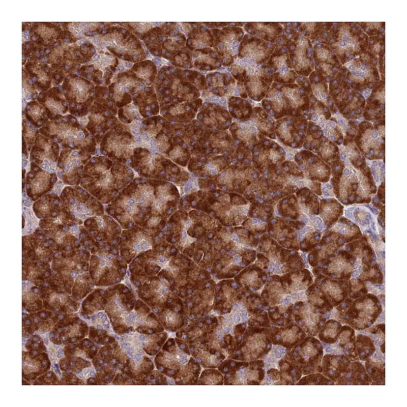 Atlas Antibodies Anti-SPATA2 Antibody