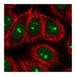 Atlas Antibodies Anti-SPATA2 Antibody