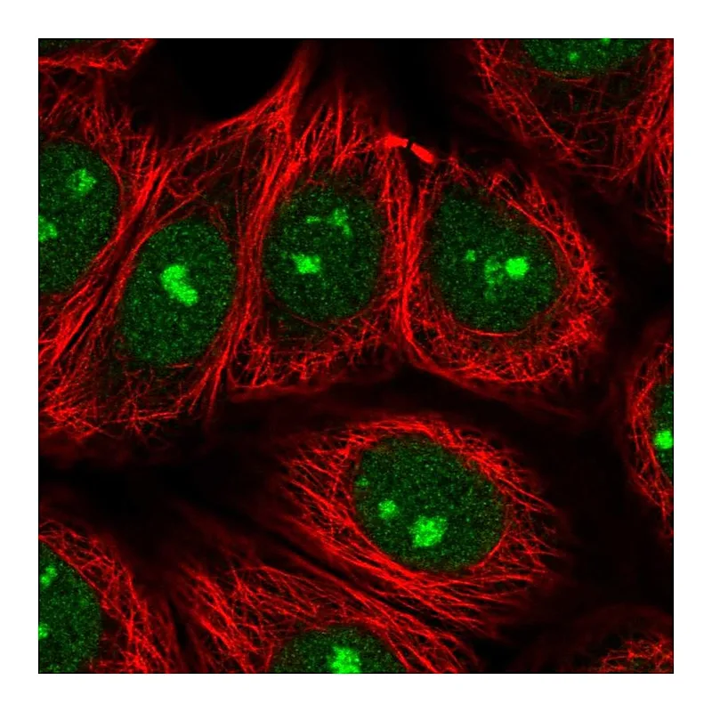 Atlas Antibodies Anti-SPATA2 Antibody