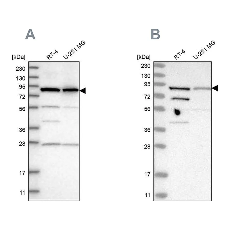 Atlas Antibodies Anti-SPATA20 Antibody
