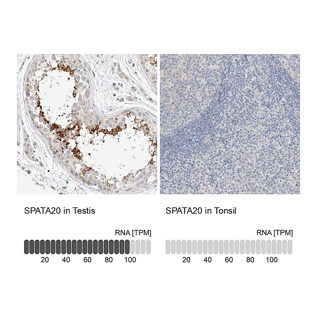 Atlas Antibodies Anti-SPATA20 Antibody
