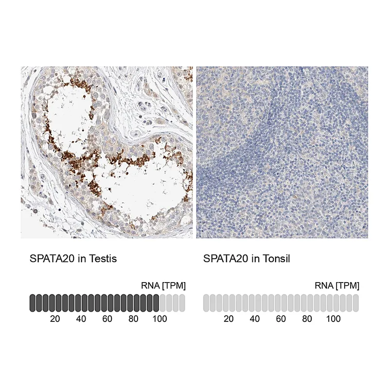 Atlas Antibodies Anti-SPATA20 Antibody