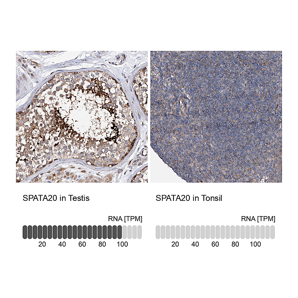 Atlas Antibodies Anti-SPATA20 Antibody