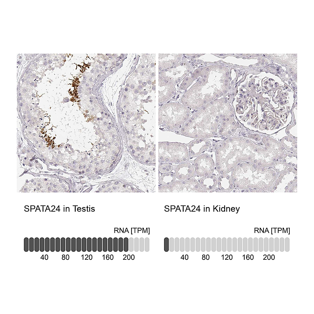 Atlas Antibodies Anti-SPATA24 Antibody