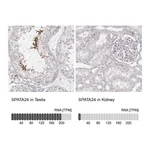 Atlas Antibodies Anti-SPATA24 Antibody