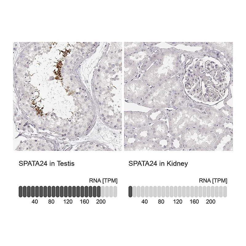 Atlas Antibodies Anti-SPATA24 Antibody