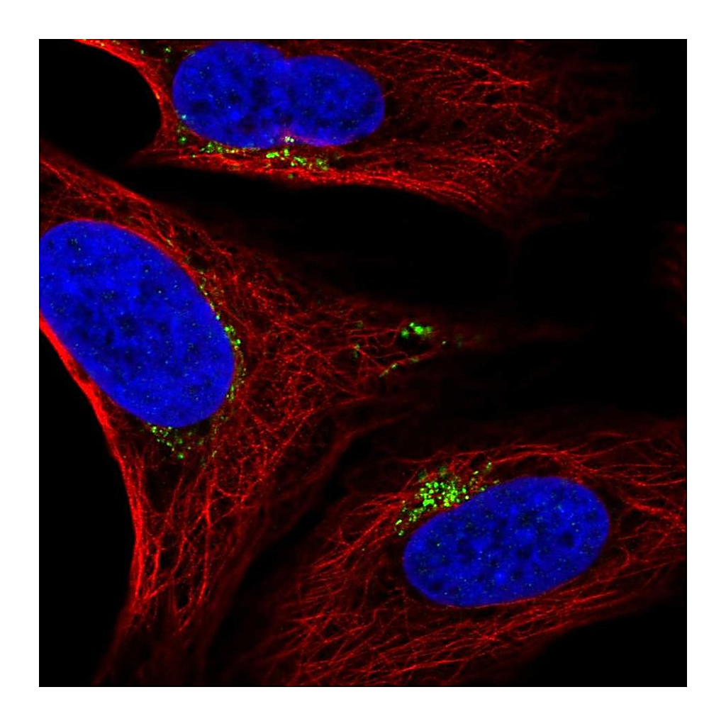 Atlas Antibodies Anti-SPATA25 Antibody
