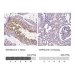 Atlas Antibodies Anti-SPATA31E1 Antibody