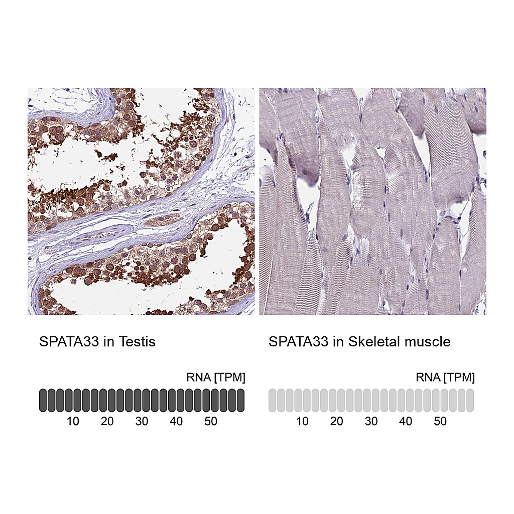 Atlas Antibodies Anti-SPATA33 Antibody