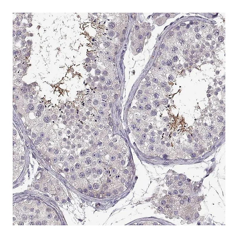 Atlas Antibodies Anti-SPATA32 Antibody