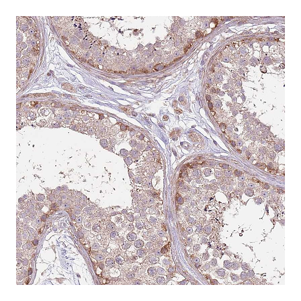 Atlas Antibodies Anti-SPATA31D1 Antibody