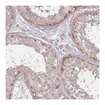 Atlas Antibodies Anti-SPATA31D1 Antibody