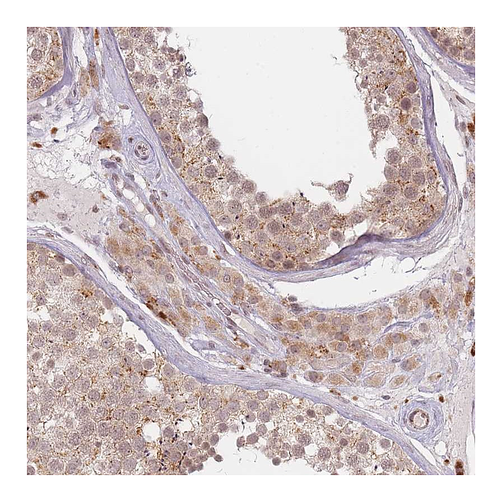 Atlas Antibodies Anti-SPATA45 Antibody