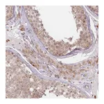 Atlas Antibodies Anti-SPATA45 Antibody