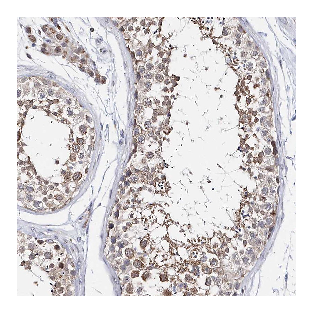 Atlas Antibodies Anti-SPATA5 Antibody
