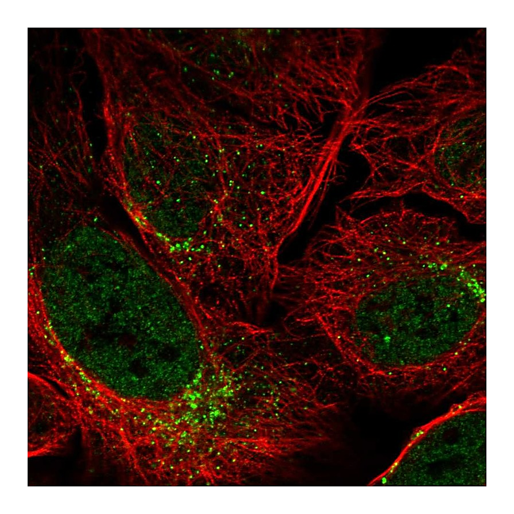 Atlas Antibodies Anti-SPATA6 Antibody