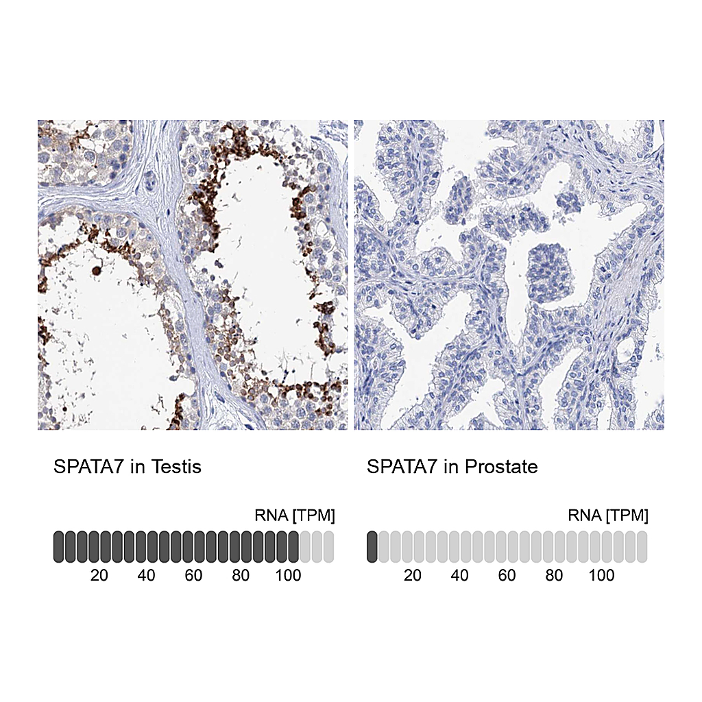 Atlas Antibodies Anti-SPATA7 Antibody