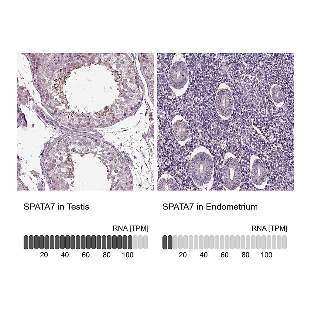 Atlas Antibodies Anti-SPATA7 Antibody