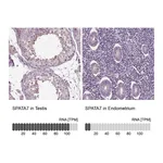 Atlas Antibodies Anti-SPATA7 Antibody