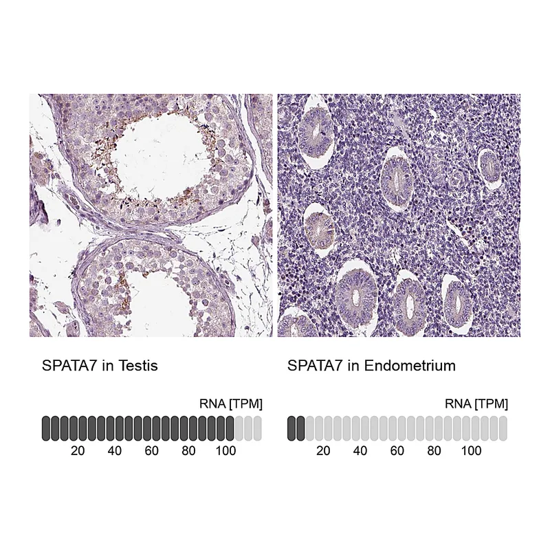 Atlas Antibodies Anti-SPATA7 Antibody