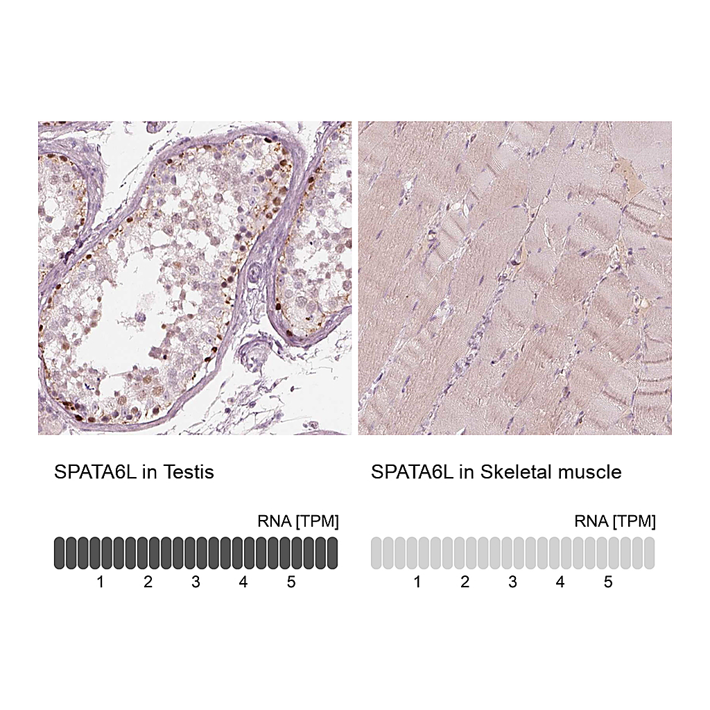 Atlas Antibodies Anti-SPATA6L Antibody