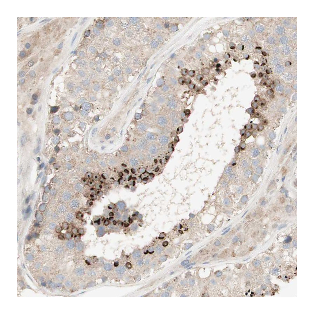 Atlas Antibodies Anti-SPATA9 Antibody