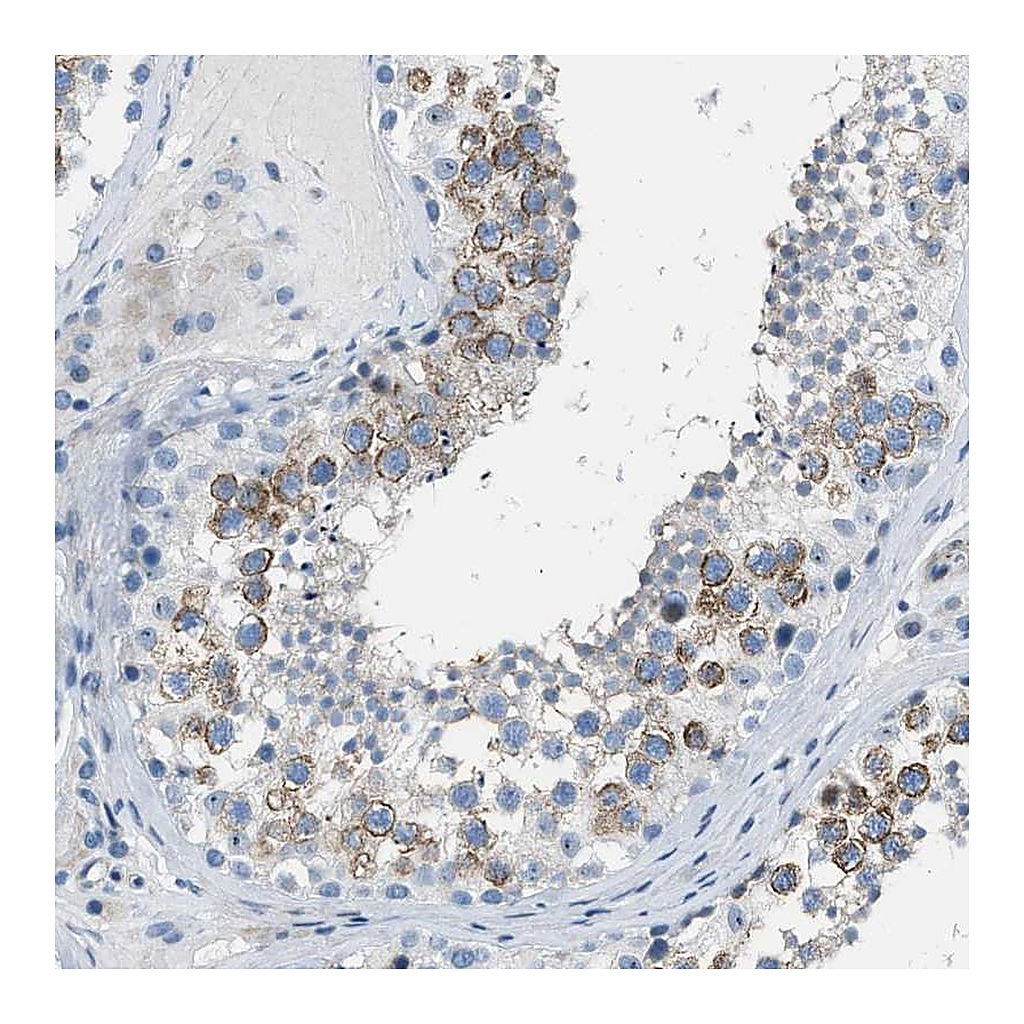 Atlas Antibodies Anti-SPATC1L Antibody
