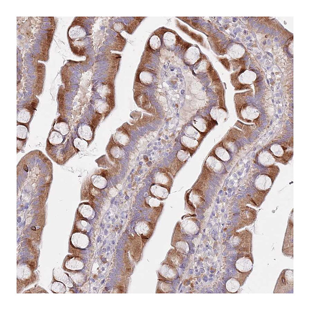 Atlas Antibodies Anti-SPATS1 Antibody