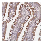 Atlas Antibodies Anti-SPATS1 Antibody