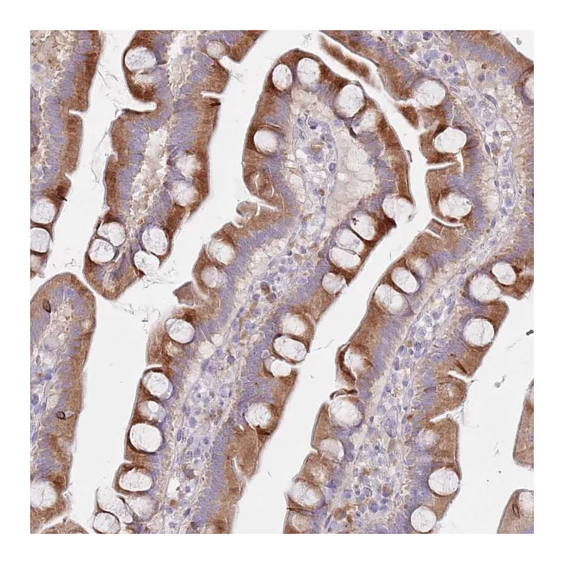 Atlas Antibodies Anti-SPATS1 Antibody