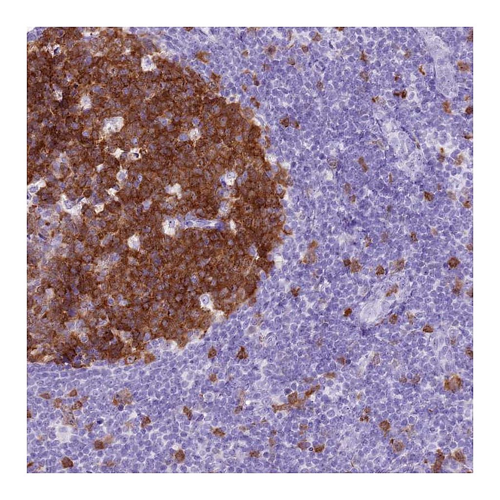 Atlas Antibodies Anti-SPC25 Antibody