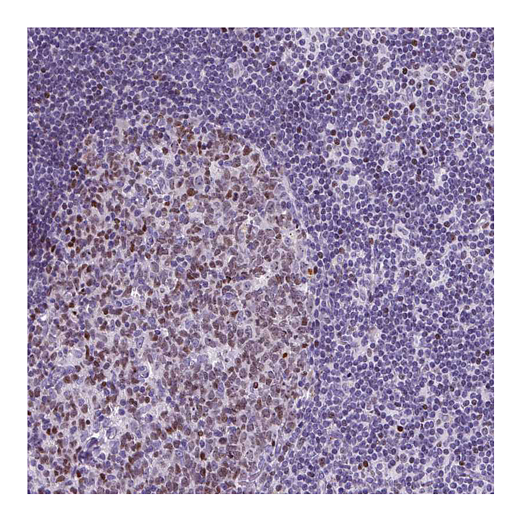 Atlas Antibodies Anti-SPC24 Antibody