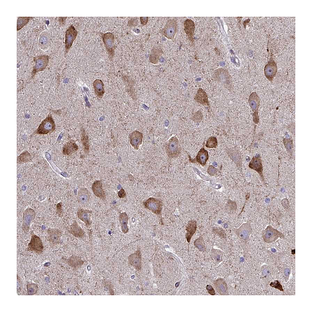 Atlas Antibodies Anti-SPATS2L Antibody