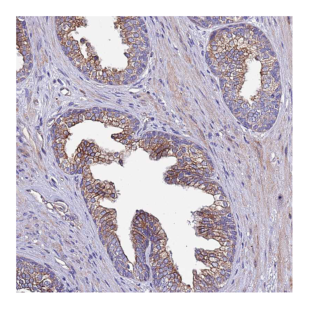 Atlas Antibodies Anti-SPCS1 Antibody