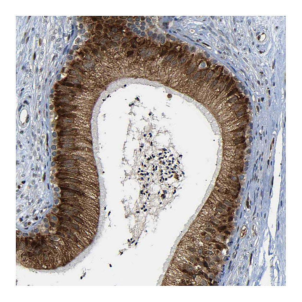 Atlas Antibodies Anti-SPCS2 Antibody