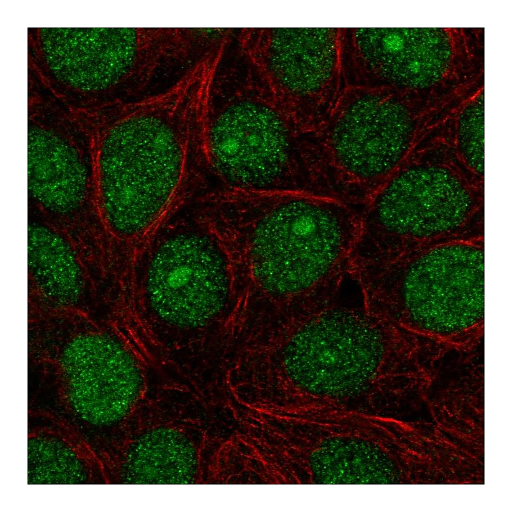 Atlas Antibodies Anti-SPDEF Antibody