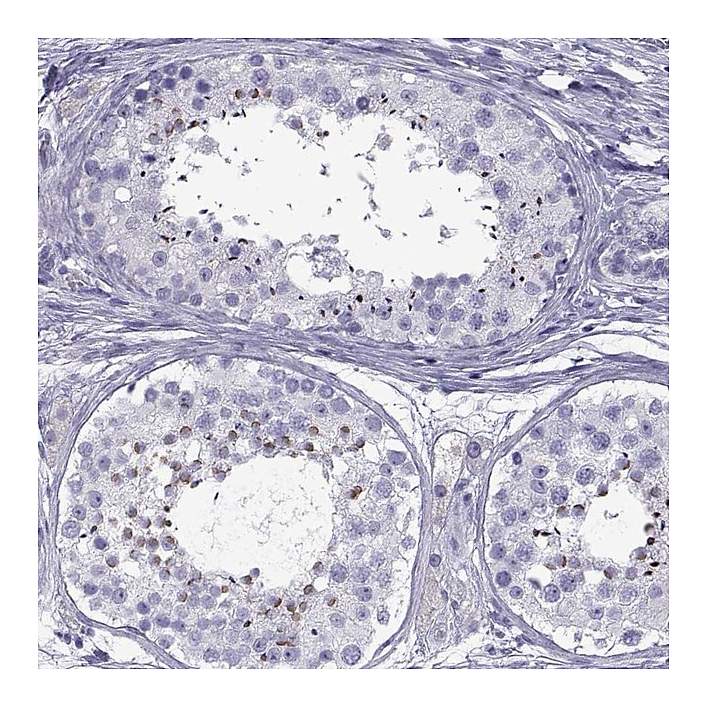 Atlas Antibodies Anti-SPDYE1 Antibody