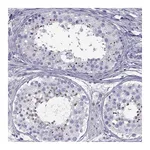 Atlas Antibodies Anti-SPDYE1 Antibody