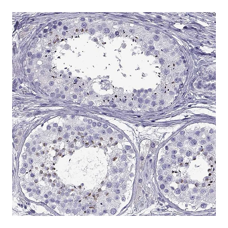 Atlas Antibodies Anti-SPDYE1 Antibody